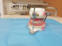 Preturi implanturi dentare